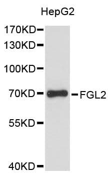 Polyclonal Rabbit anti-Human FGL2 Antibody (WB)