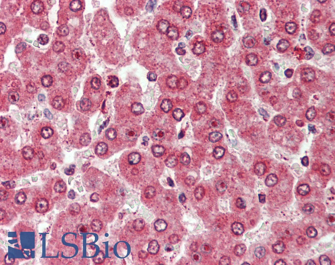 IHC-plus™ CXADR Antibody (Internal)