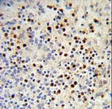 MDFIC / HIC Antibody (aa73-99)