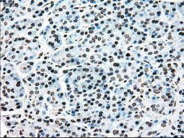 Monoclonal Mouse anti-Human MAP2K4 / MKK4 Antibody (clone OTI2E4, IHC, IF, WB)