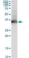 Monoclonal Mouse anti-Human GAPDH Antibody (clone 3C2, WB)