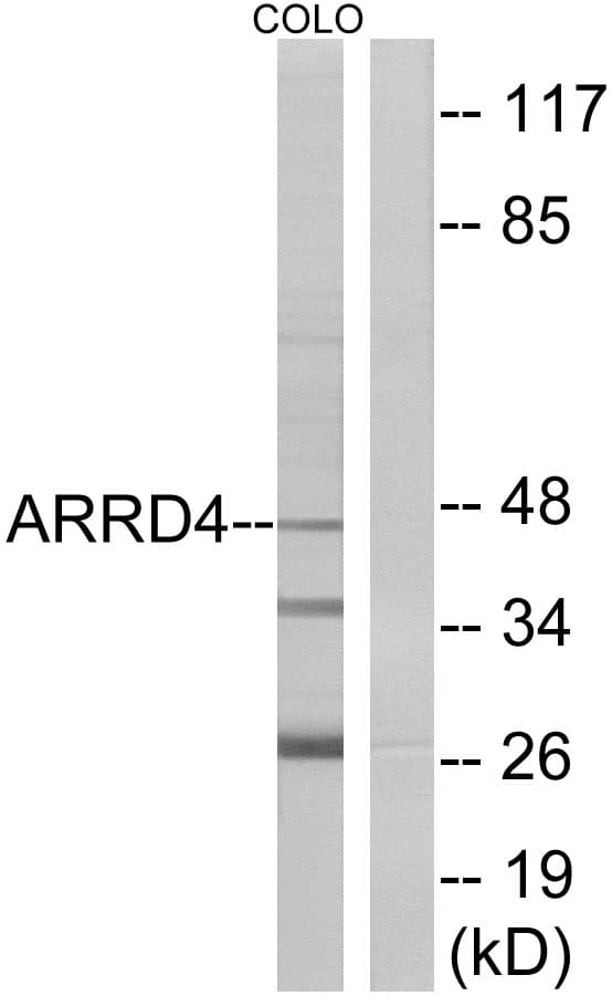 ARRDC4 Antibody (aa127-176)