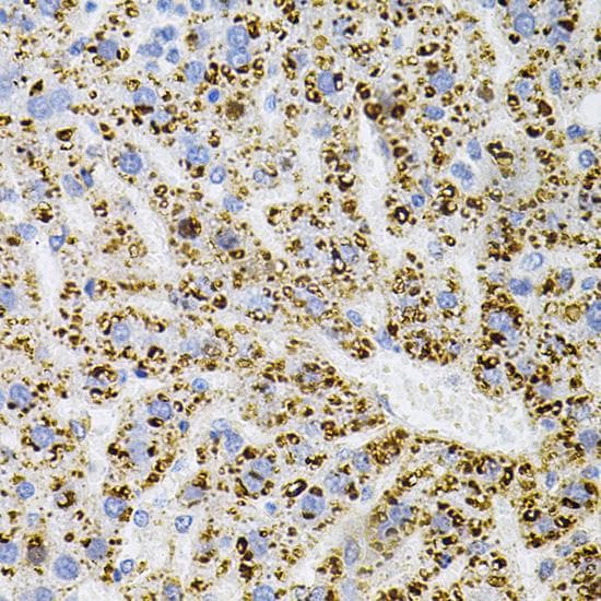 NTRK1 / TrkA Antibody