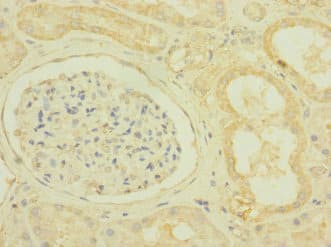 Polyclonal Rabbit anti-Human SCN7A Antibody (IHC, WB)