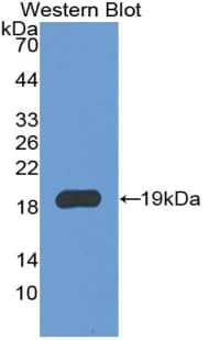AIF1 / IBA1 Antibody (aa1-147)