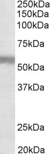 IHC-plus™ NPR3 Antibody (aa520-533)