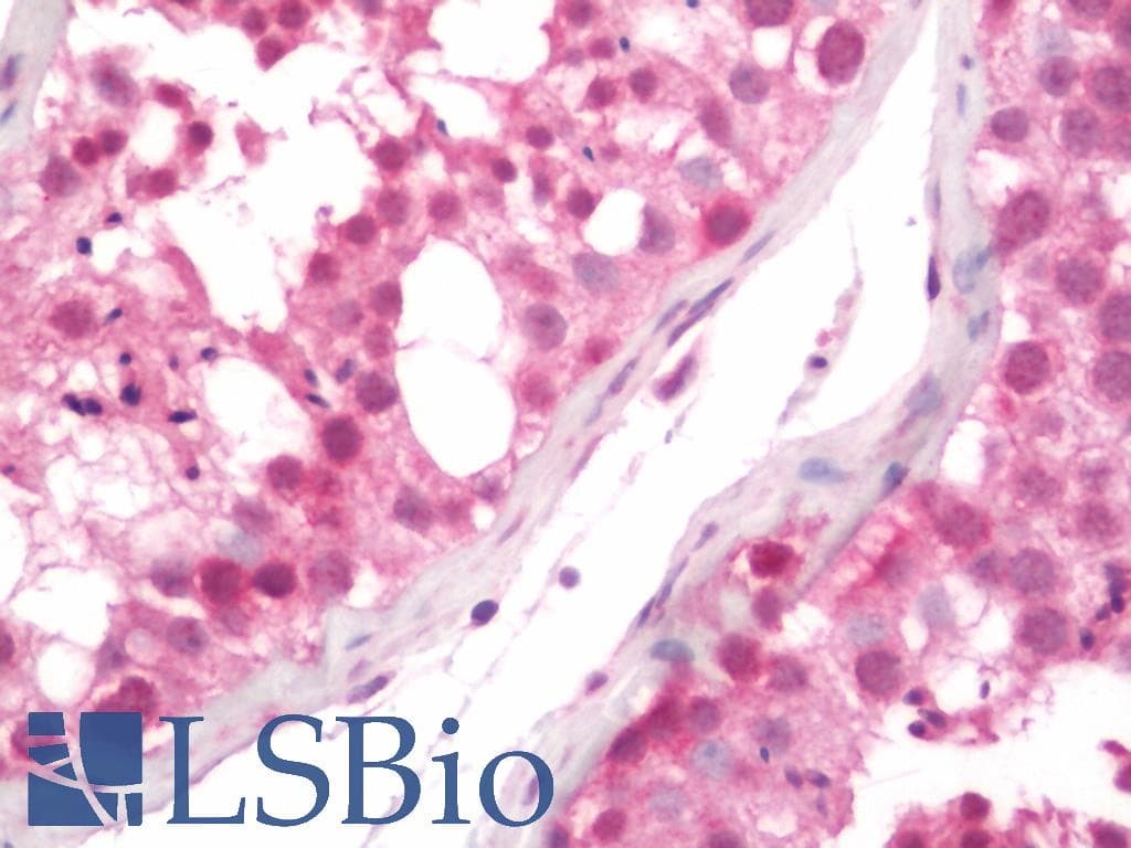 IHC-plus™ PTPN5 / STEP Antibody