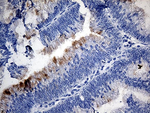 TFF1 / pS2 Antibody (aa25-84, clone OTI5H5)