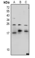 Polyclonal Rabbit anti-Human MBP / Maltose Binding Protein Antibody (WB)