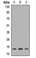 RPS10 / Ribosomal Protein S10 Antibody