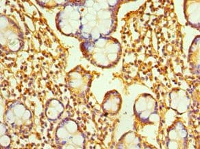 Polyclonal Rabbit anti-Human RAB4A / RAB4 Antibody (aa1-218, IHC)