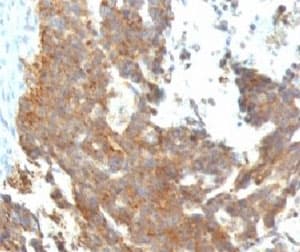 GnRH receptor / GNRHR Antibody (clone GNRHR/768)