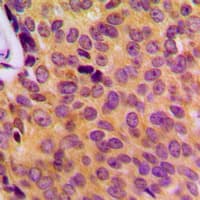 MOBKL2B / MOB3B Antibody (Internal)