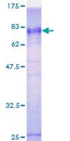 Human ZRANB2 / ZNF265 Protein (Recombinant GST)