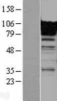 FCN3 / Ficolin-3 Protein (Over-Expression Lysate Myc-DDK (Flag))