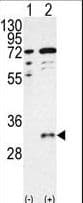 CTDSP1 / SCP1 Antibody (aa235-261)