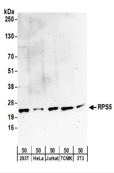 Polyclonal Rabbit anti-Human RPS5 / Ribosomal Protein S5 Antibody (aa50-100, WB)