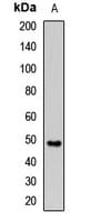 CFH / Complement Factor H Antibody