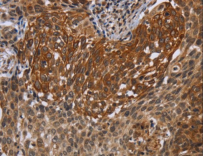 NIRF / UHRF2 Antibody