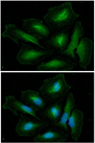 PathPlus™ Monoclonal Mouse anti-Human GLUL / Glutamine Synthetase Antibody (clone AT8D7, IHC, IF, WB)