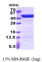 Human UBXN2B Protein (Recombinant His)