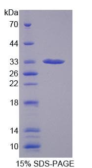 Human GBP1 Protein (Recombinant His, N-Terminal)