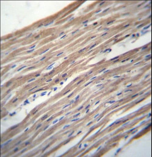 Polyclonal Rabbit anti-Human HRC / HCP Antibody (aa277-306, IHC, WB)