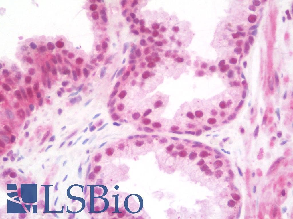 IHC-plus™ TRIM33 / TIF1-Gamma Antibody