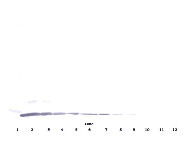 CCL2 / MCP1 Antibody