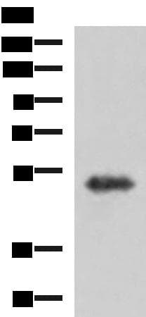 Polyclonal Rabbit anti-Human TSEN2 Antibody (IHC, WB)