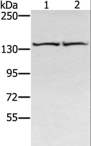 Polyclonal Rabbit anti-Human RGS22 Antibody (IHC, WB)