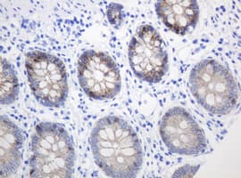 CTNND1 / p120 Catenin Antibody (clone OTI2F8)