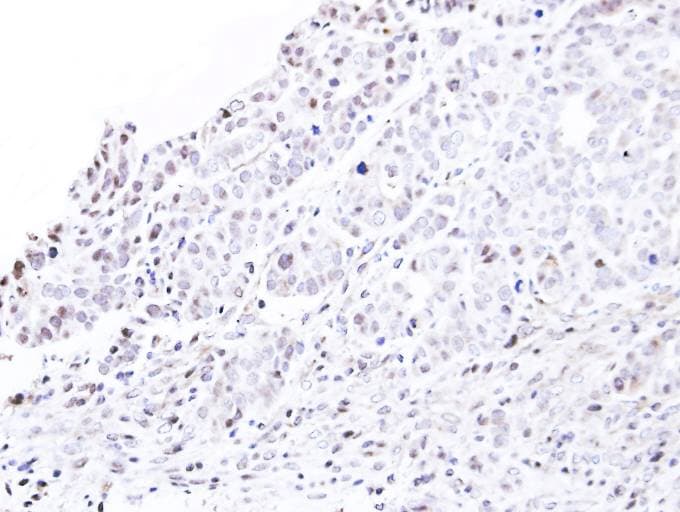 NUP62 Antibody (aa230-490)