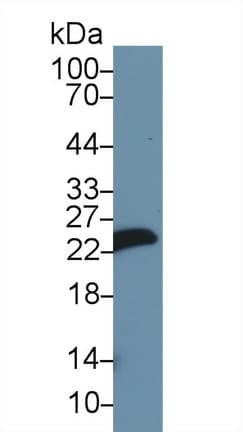 MLC3F / MYL1 Antibody (aa3-139)