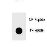 BAD Antibody (phospho-Ser91)