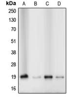 IHC-plus™ CFL1 / Cofilin Antibody (N-Terminus)