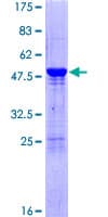 Human UBE2K / LIG Protein (Recombinant GST)
