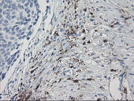 F13A1 / Factor XIIIa Antibody (clone OTI9E2)
