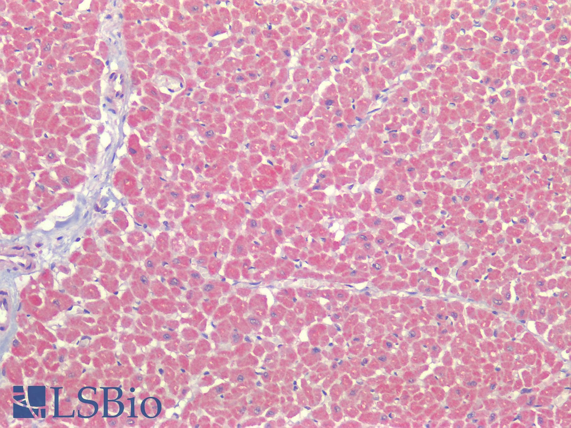 IHC-plus™ AGTR2 / AT2 Receptor Antibody (Internal)