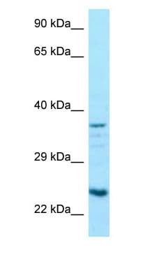 RPS5 / Ribosomal Protein S5 Antibody (C-Terminus)