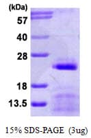 Human SNRPC / U1C Protein (Recombinant His)