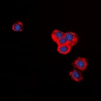 Polyclonal Rabbit anti-Human BID Antibody (Internal, IHC, IF, WB)