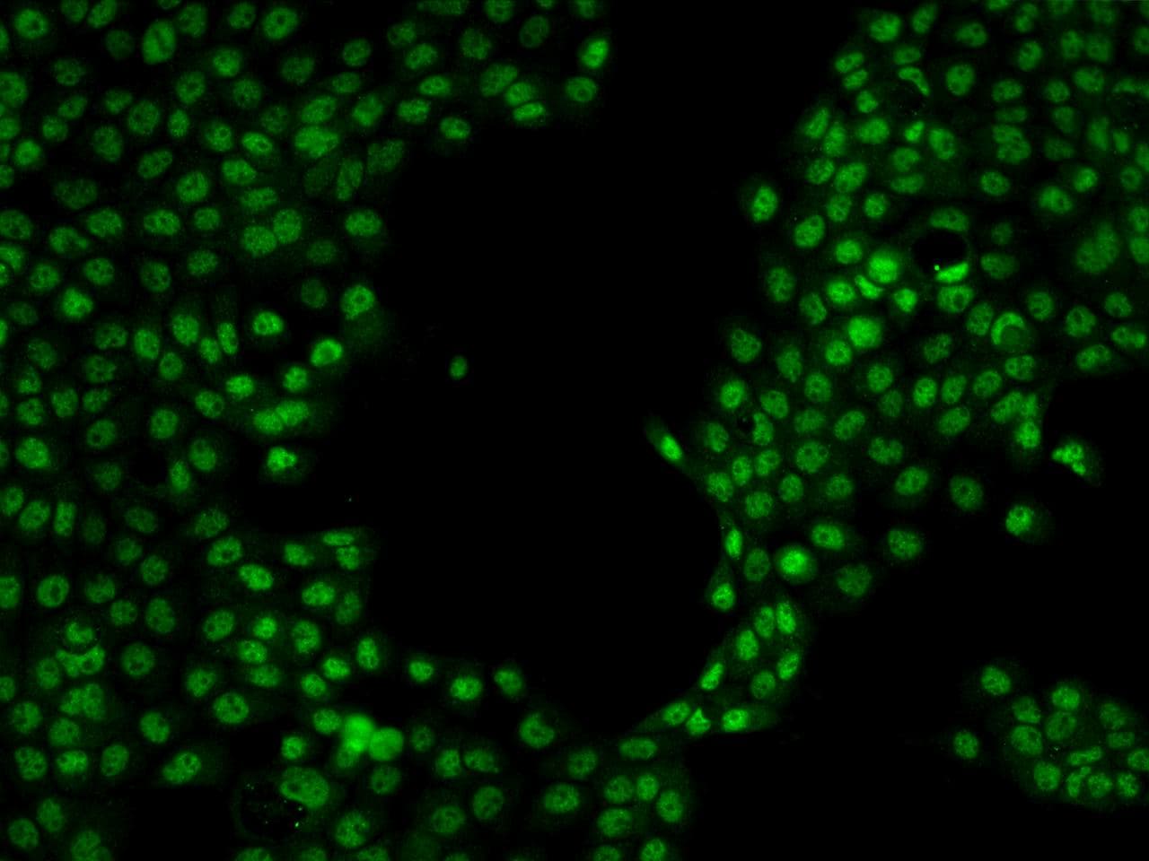SR140 / U2SURP Antibody