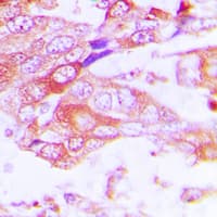 CYP2A13 Antibody (Internal)