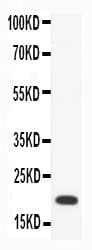 Polyclonal Rabbit anti-Human CCL18 / PARC Antibody (aa21-89, WB)