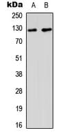 Polyclonal Rabbit anti-Human MSH3 Antibody (N-Terminus, IHC, WB)