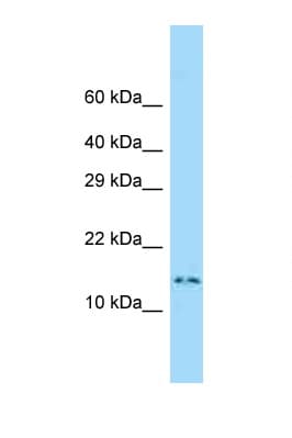 DNAL4 / Dynein Light Chain 4 Antibody (C-Terminus)