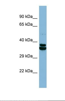 Polyclonal Rabbit anti-Human CCDC67 Antibody (aa113-162, WB)