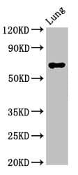 Polyclonal Rabbit anti-Human TFEB Antibody (IHC, IF)