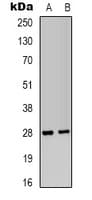 IGFBP1 Antibody (Internal)